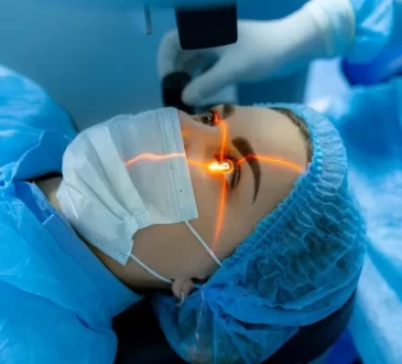 Cataract Surgery